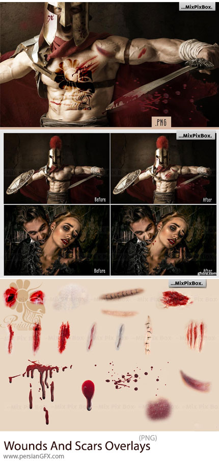 دانلود تصاویر پوششی زخم، جراحات و بخیه - Wounds And Scars Overlays