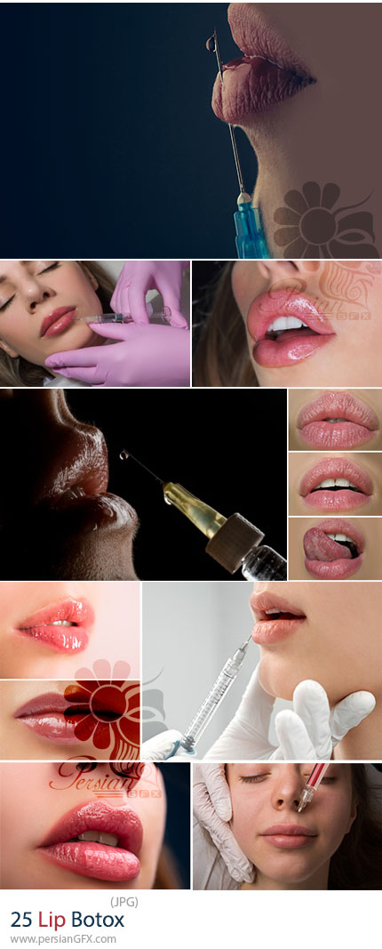 دانلود 25 عکس با کیفیت بوتاکس و تزریق لب - Lip Botox