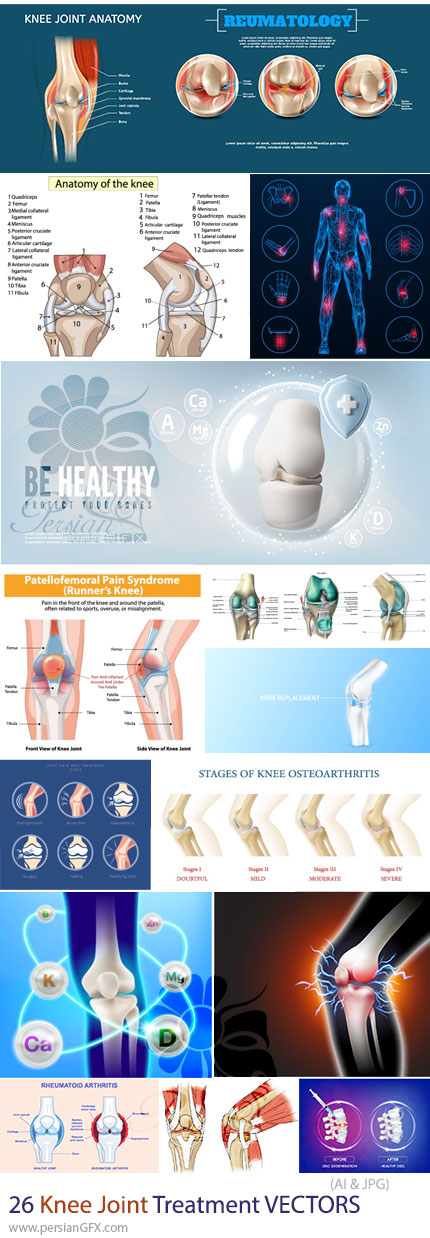 دانلود 26 وکتور درمان و مراقبت مفصل زانو و فیزیوتراپی - Knee Joint Treatment Vectors